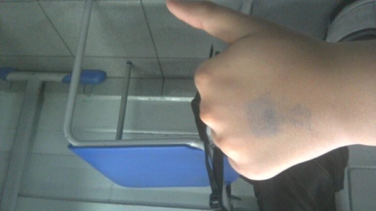 teste