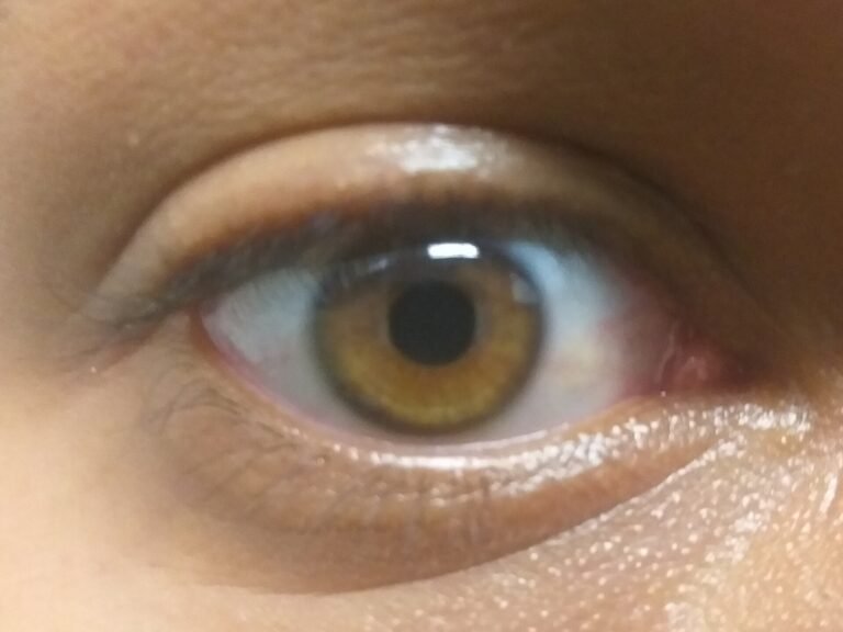 Amber eye